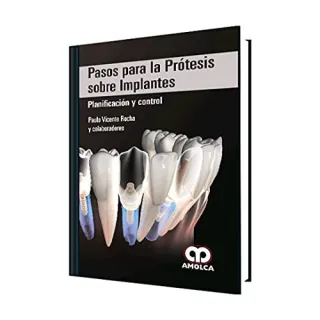 Portada de Pasos para la prótesis sobre implantes planificación y control