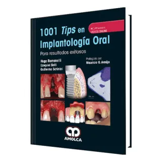 Portada de 1001 tips en implantología oral para resultados exitosos