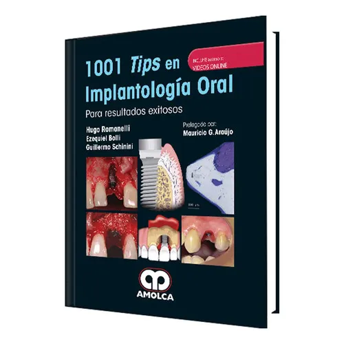 Portada de 1001 tips en implantología oral para resultados exitosos