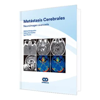 Portada de Metástasis Cerebrales / Neuroimagen avanzada