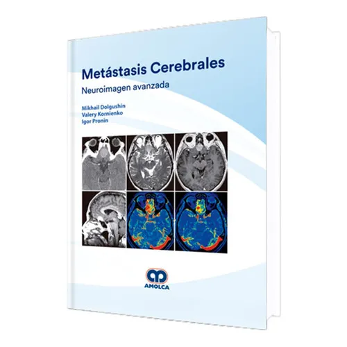 Portada de Metástasis Cerebrales / Neuroimagen avanzada