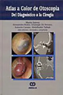 Portada de Atlas a color de otoscopia del diagnóstico a la cirugía