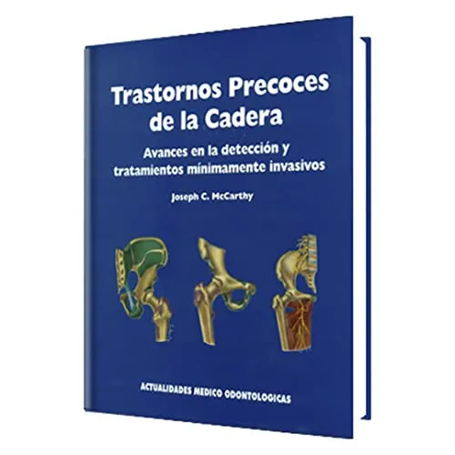 Portada de Trastornos precoces de la cadera Avances en la detección y tratamientos mínimamente invasivos