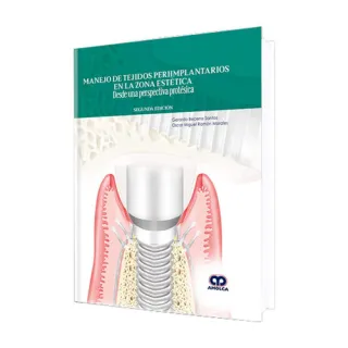 Portada de Manejo de Tejidos Periimplantarios en la Zona Estética. (Spanish Edition)