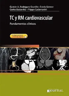 Portada de TC Y RM cardiovascular. Fundamentos clínicos
