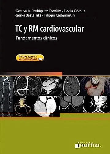 Portada de TC Y RM cardiovascular. Fundamentos clínicos