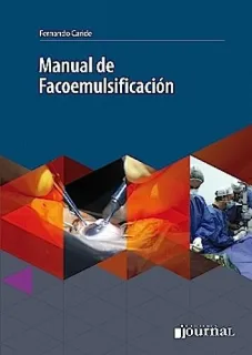 Portada de Manual de facoemulsificación