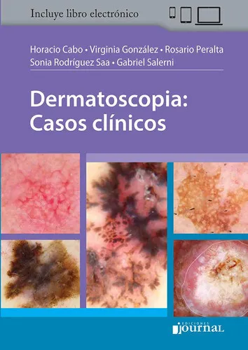 Portada de Dermatoscopia : casos clínicos