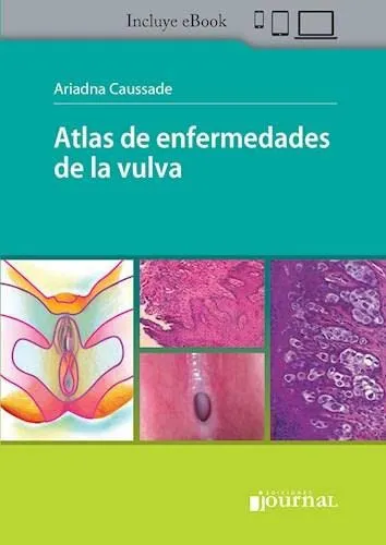 Portada de Atlas de enfermedades de la vulva