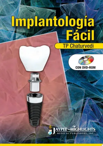 Portada de Implantología Fácil