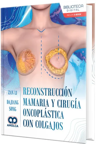 Portada de Reconstrucción mamaria y cirugía oncoplástica con colgajos