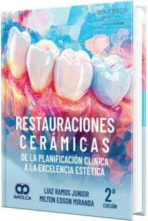 Portada de Restauraciones cerámicas. De la planificación clínica a la excelencia estética