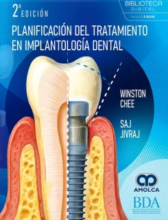Portada de Planificación del tratamiento en implantología dental