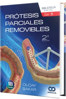 Portada de Prótesis parciales removibles