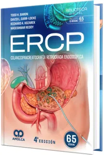 Portada de ERCP. Colangiopancreatografía retrógrada endoscópica