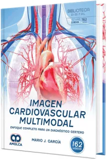 Portada de Imagen cardiovascular multimodal. Enfoque completo para un diagnóstico certero