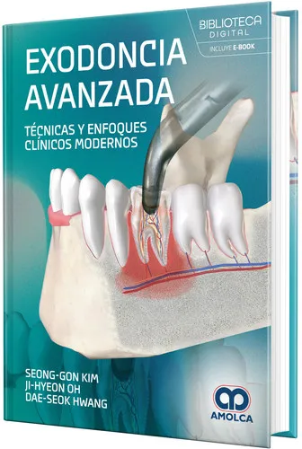 Portada de GON KIM, Exodoncia avanzada. Técnicas y enfoques clínicos modernos